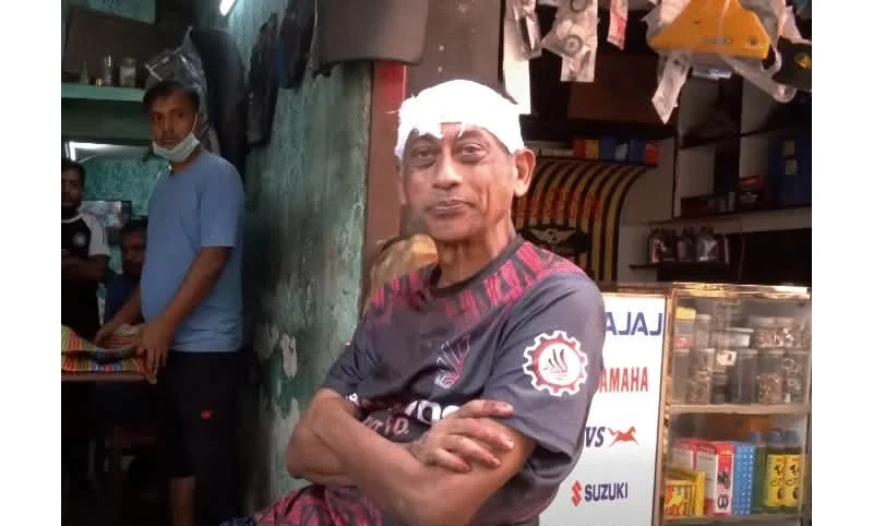 যশোরে বাড়ির সামনে ময়লা ফেলা নিয়ে বিরোধ, লাঠির আঘাতে আহত শিল্পী সমু চৌধুরী